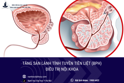 Tăng sản lành tính tuyến tiền liệt: Điều trị nội khoa