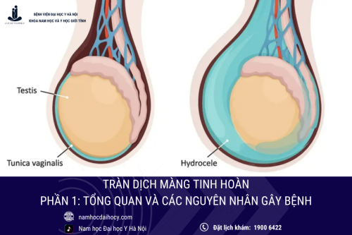 Tràn dịch màng tinh hoàn (phần 1): Tổng quan và các nguyên nhân gây bệnh