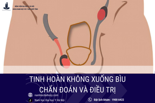 Tinh hoàn không xuống bìu: Chẩn đoán và điều trị