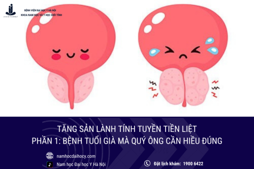 Tổng quan về tăng sản tuyến tiền liệt lành tính: Bệnh tuổi già mà quý ông cần hiểu đúng