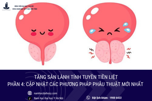 Các phương pháp phẫu thuật tăng sản tuyến tiền liệt: Cập nhật xu hướng mới nhất