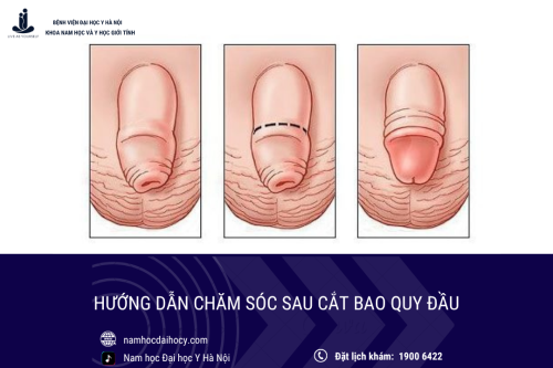 HƯỚNG DẪN CHĂM SÓC SAU CẮT BAO QUY ĐẦU